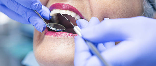 Best Emergency Tooth Extraction in Runaway Bay, TX